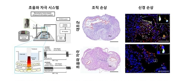 케이메디허브(대구경북첨단의료산업진흥재단, 이사장 양진영)는 하반신 마비 척수손상을 치료할 수 있는 초음파 치료기술 개발 논문을 발표했다.
